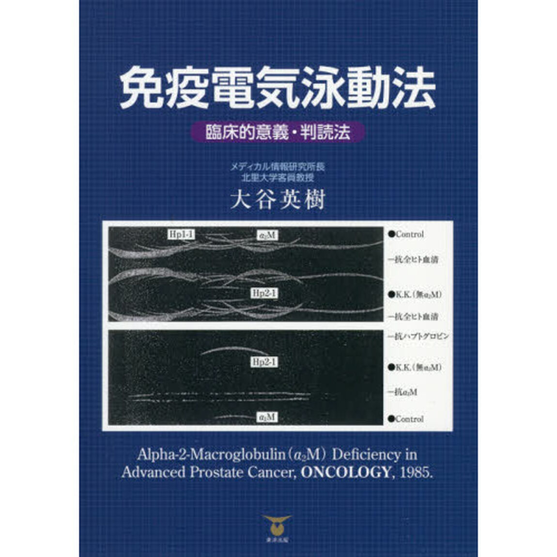 免疫電気泳動法　臨床的意義・判読法