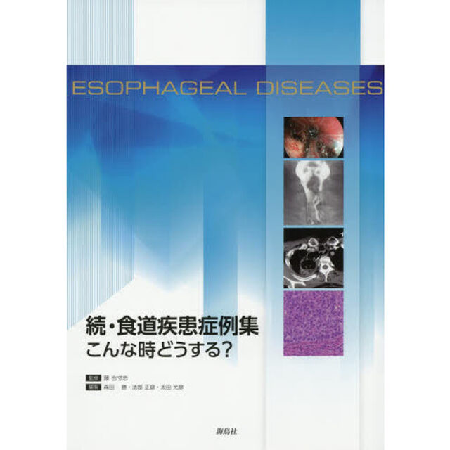 食道疾患症例集　こんな時どうする？　続