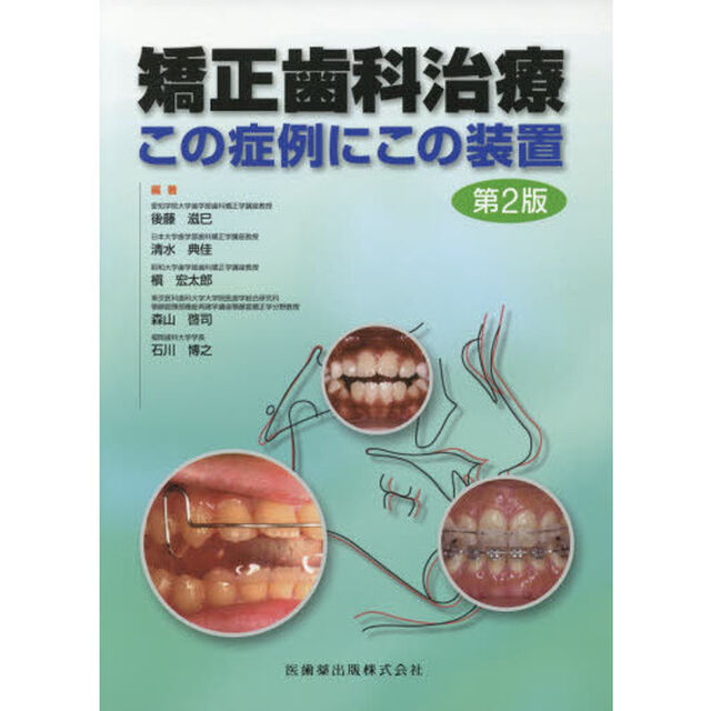 矯正歯科治療　この症例にこの装置「第２版」