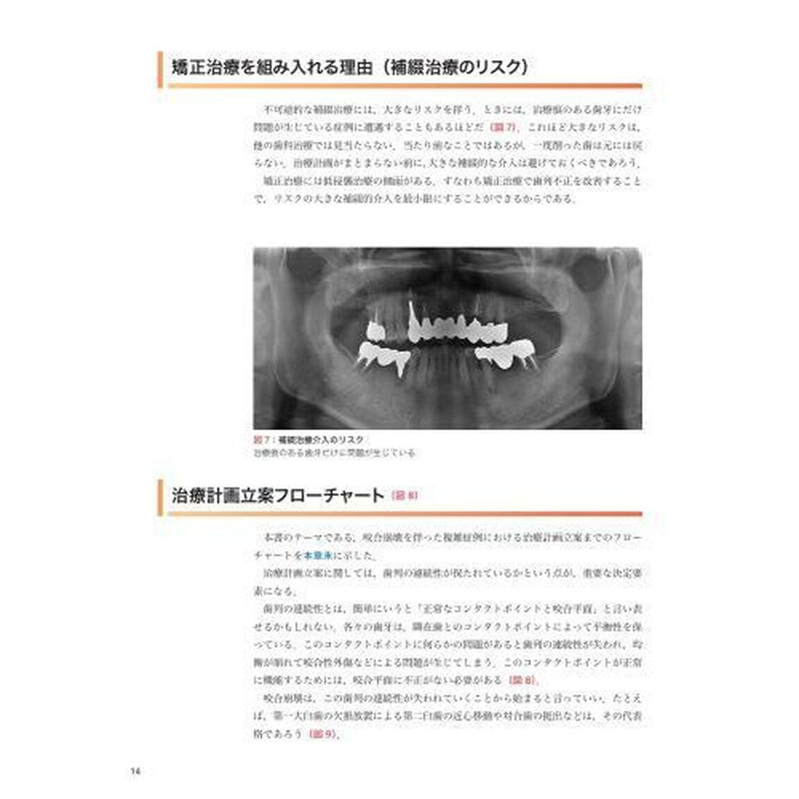 ＧＰが行う矯正治療を組み入れた咬合再構成　フローチャートでわかる治療計画立案