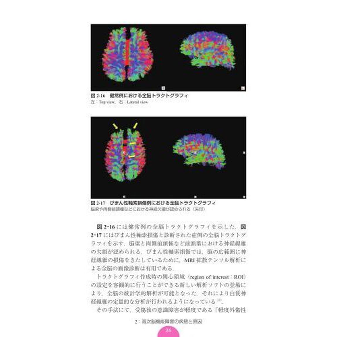 高次脳機能障害ポケットマニュアル「第４版」