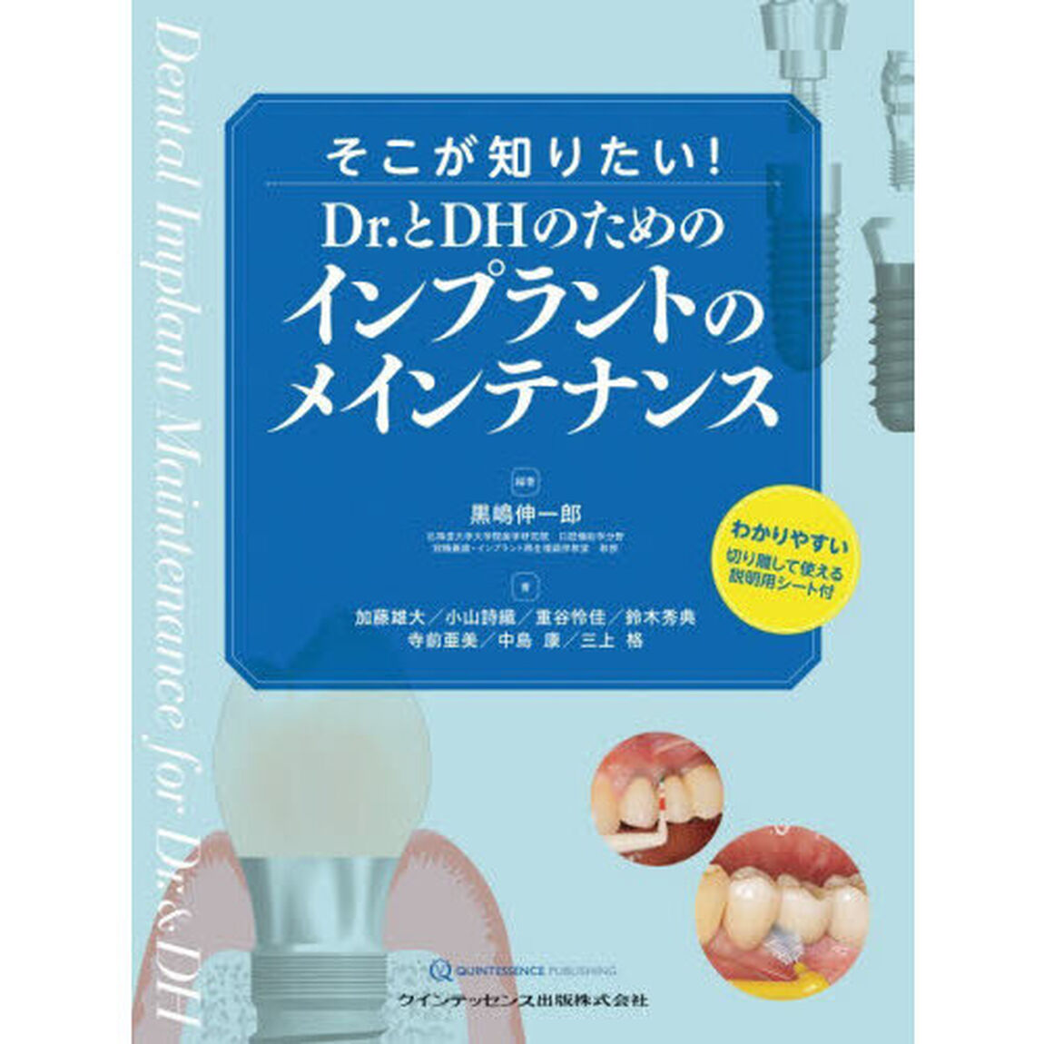 そこが知りたい！Ｄｒ．とＤＨのためのインプラントのメインテナンス