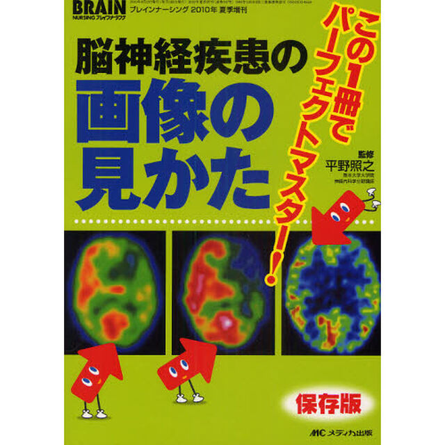 脳神経疾患の画像の見かた　この１冊でパーフェクトマスター！　保存版