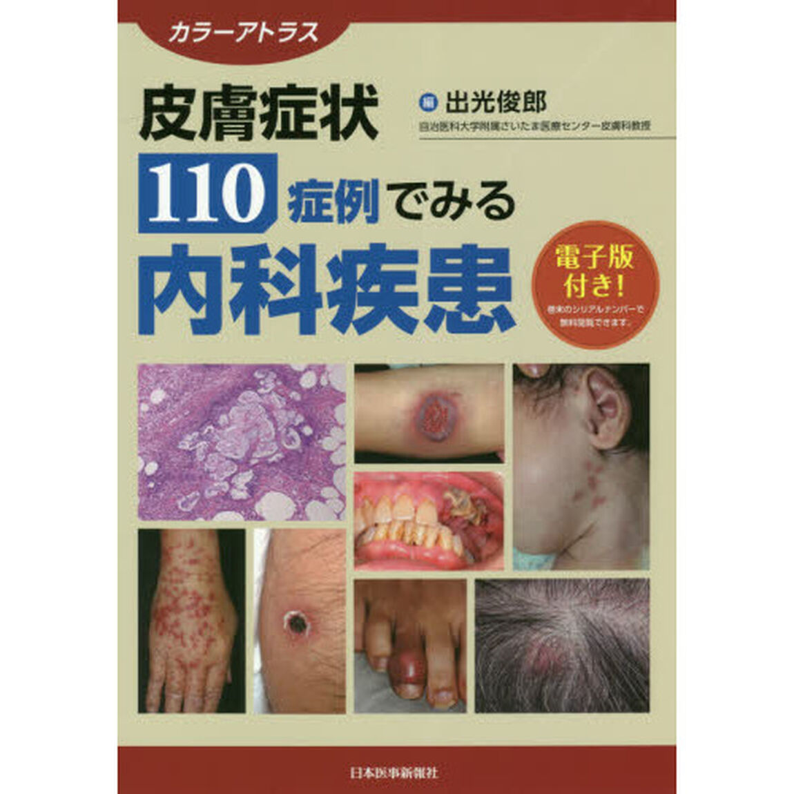 皮膚症状１１０症例でみる内科疾患　カラーアトラス