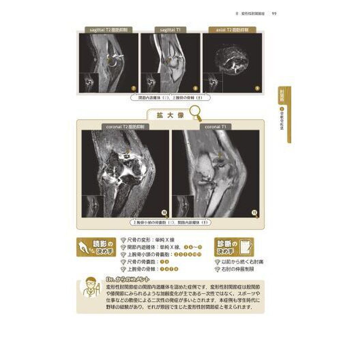 上肢ＭＲＩ読影の一手　２７０８画像からみた定跡