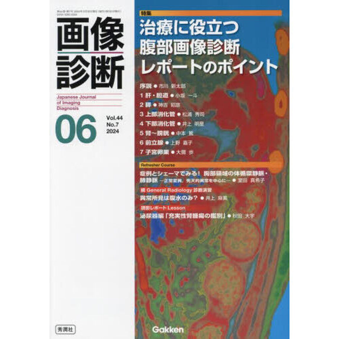画像診断　Ｖｏｌ．４４Ｎｏ．７（２０２４年６月号）「特集治療に役立つ腹部画像診断レポートのポイント」