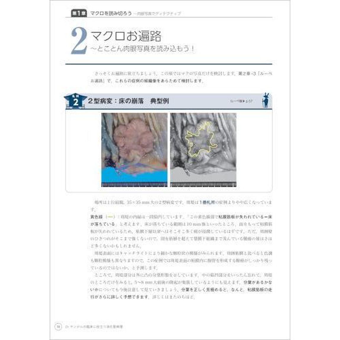 Ｄｒ．ヤンデルの臨床に役立つ消化管病理　臨床像・病理像の徹底対比で病変の本質を見抜く！