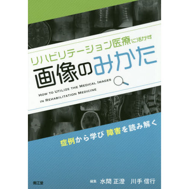 リハビリテーション医療に活かす画像のみかた　症例から学び障害を読み解く