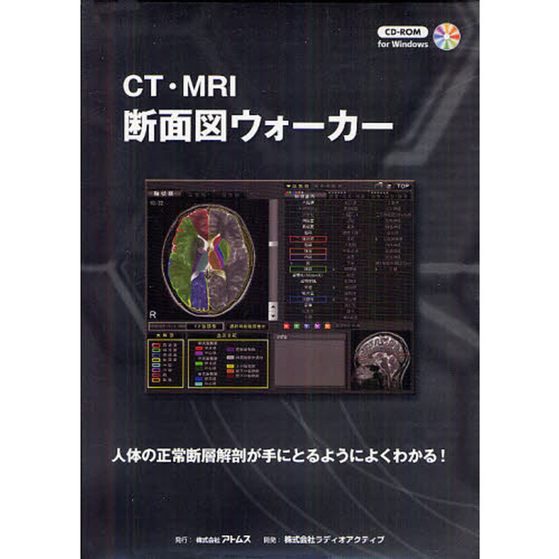 ＣＴ・ＭＲＩ断面図ウォーカー　人体の正常断層解剖が手にとるようによくわかる！