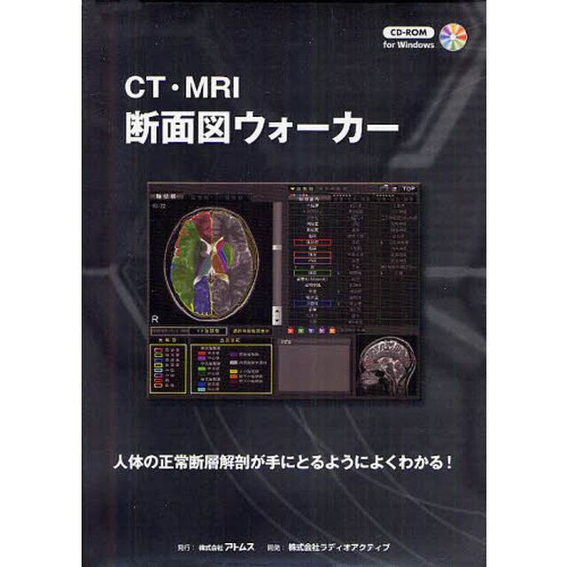 ＣＴ・ＭＲＩ断面図ウォーカー　人体の正常断層解剖が手にとるようによくわかる！