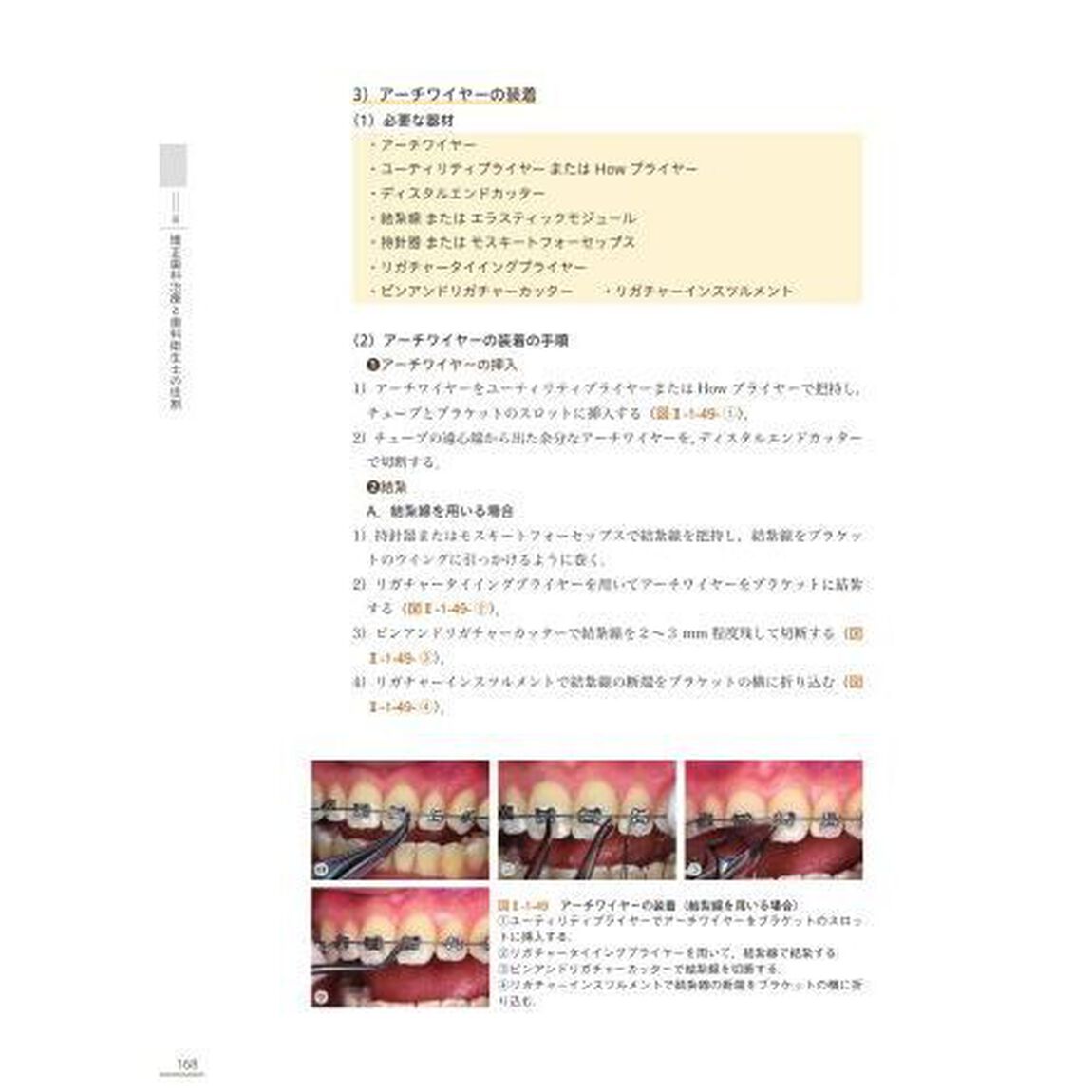 歯科矯正学「第２版」