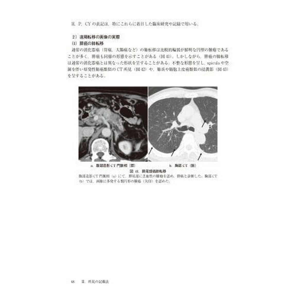 膵癌取扱い規約「第８版」
