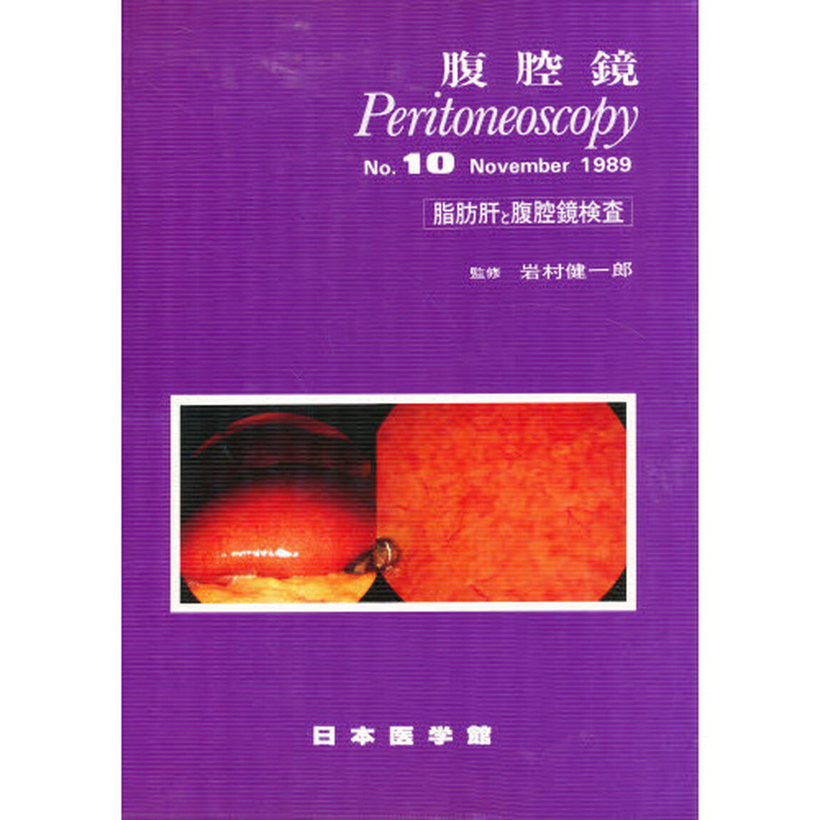 腹腔鏡　Ｎｏ．１０「脂肪肝と腹腔鏡検査　監修：岩村健一郎」