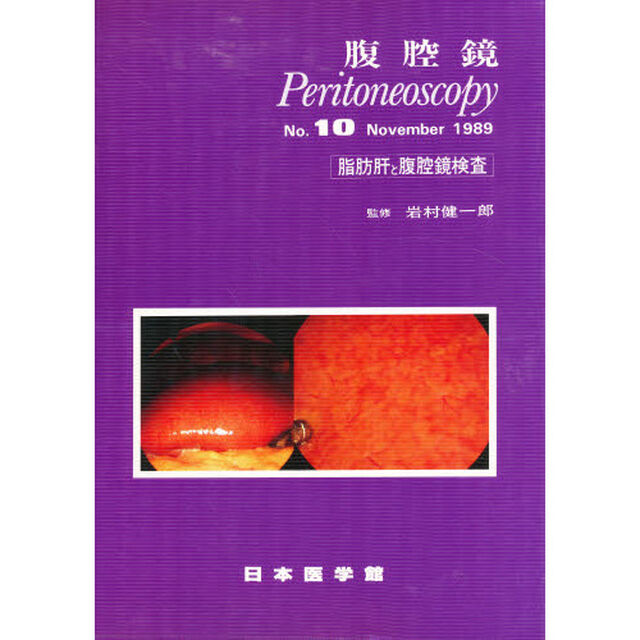 腹腔鏡　Ｎｏ．１０「脂肪肝と腹腔鏡検査　監修：岩村健一郎」