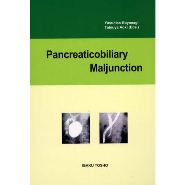 ＰａｎｃｒｅａｔｉｃｏｂｉｌｉａｒｙＭａ