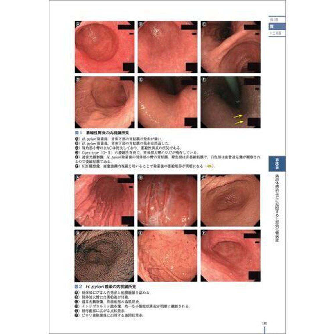 美しい画像で見る内視鏡アトラス上部消化管　腫瘍から感染性・炎症性疾患まで、典型例とピットフォール画像で鑑別点を理解する