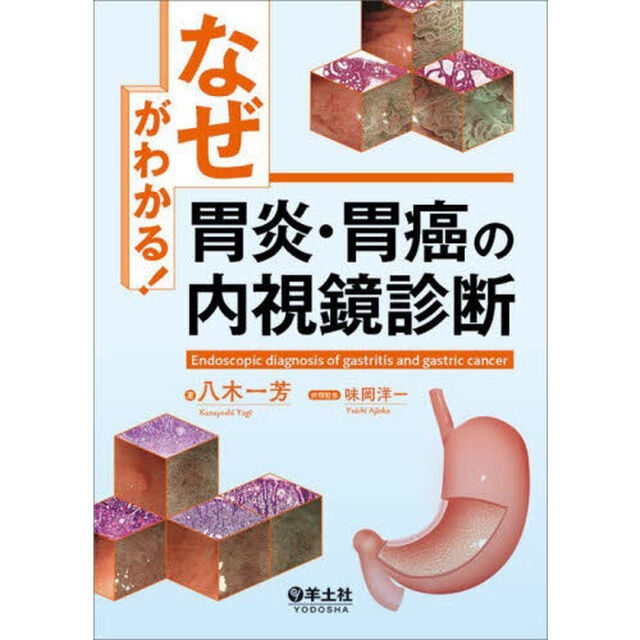 「なぜ」がわかる！胃炎・胃癌の内視鏡診断