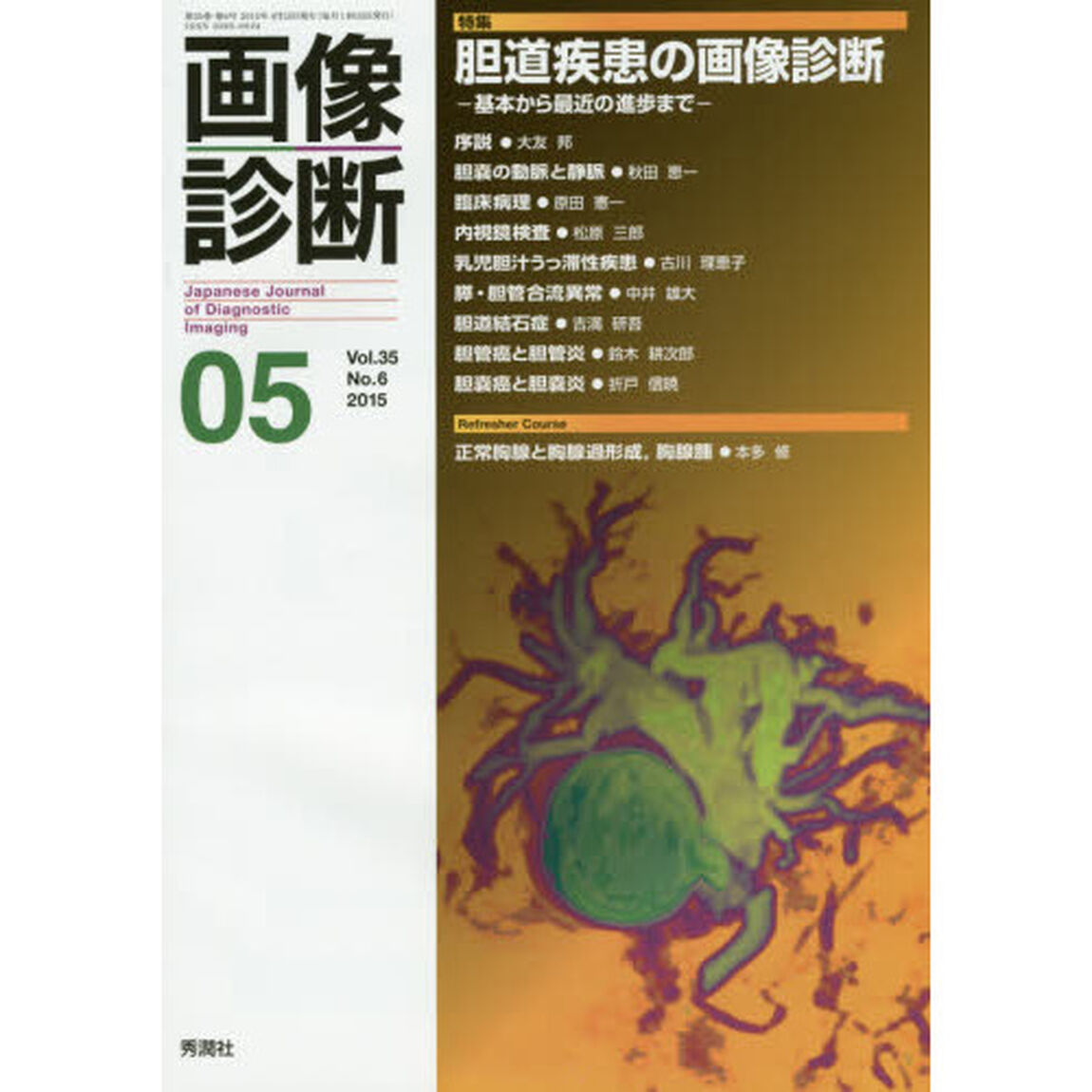 画像診断　Ｖｏｌ．３５Ｎｏ．６（２０１５－０５）「特集胆道疾患の画像診断　基本から最近の進歩まで」