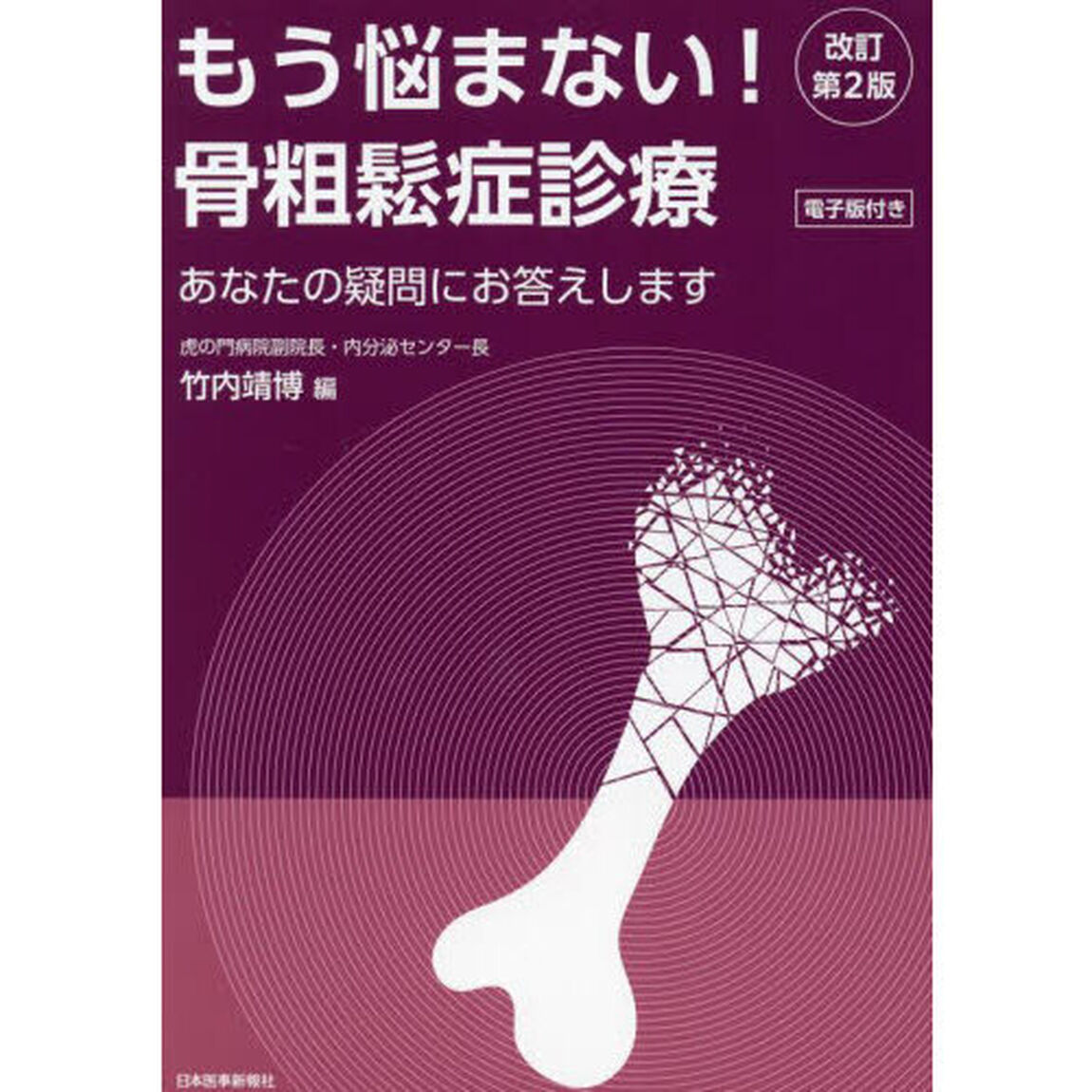 もう悩まない！骨粗鬆症診療　あなたの疑問にお答えします「改訂第２版」