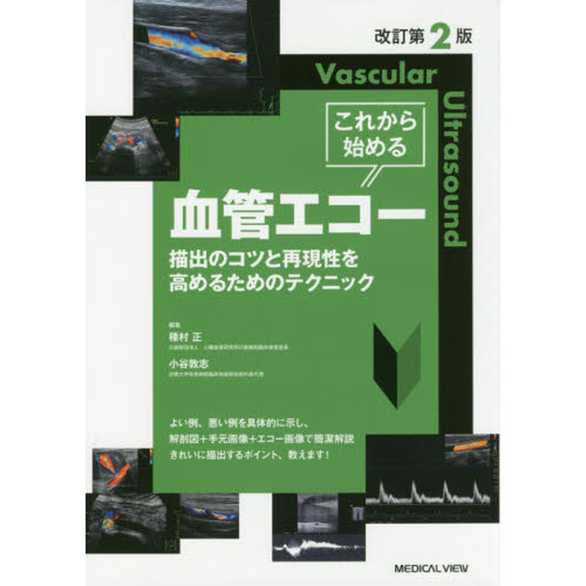 これから始める血管エコー　描出のコツと再現性を高めるためのテクニック「改訂第２版」