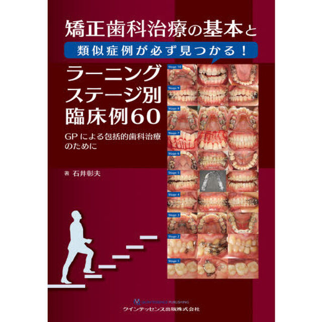 矯正歯科治療の基本と類似症例が必ず見つかる！ラーニングステージ別臨床例６０　ＧＰによる包括的歯科治療のために
