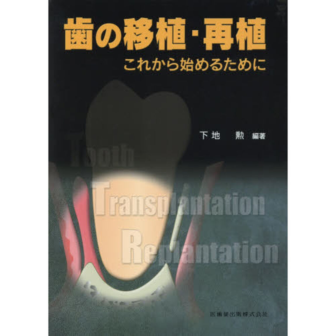 歯の移植・再植　これから始めるために