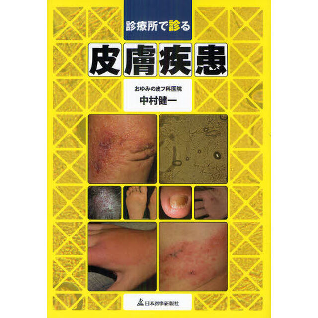 診療所で診る皮膚疾患