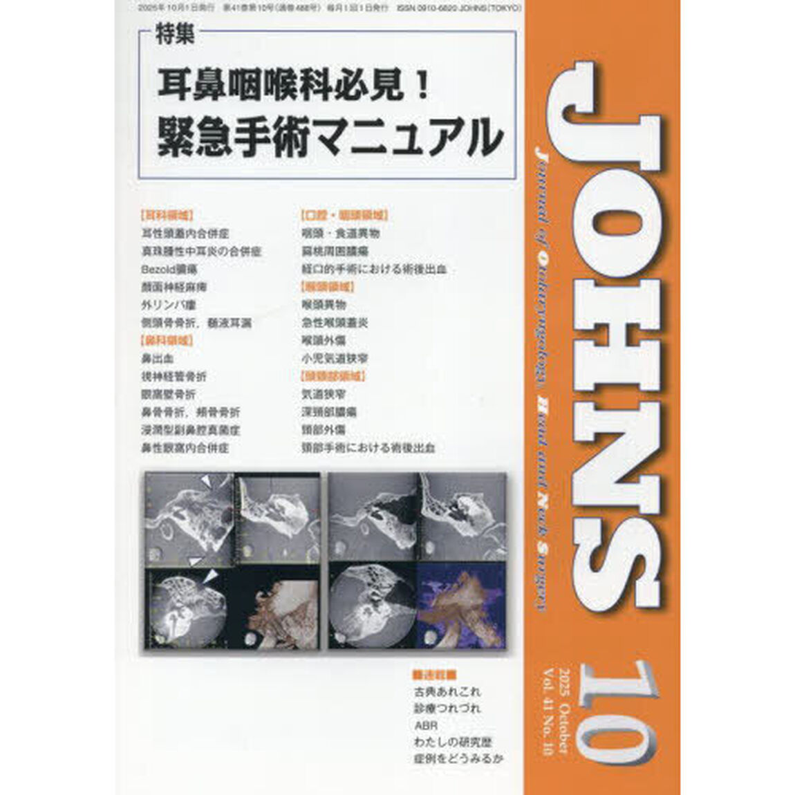 ＪＯＨＮＳ　Ｖｏｌ．４１Ｎｏ．１０（２０２５－１０）「特集耳鼻咽喉科必見！緊急手術マニュアル」