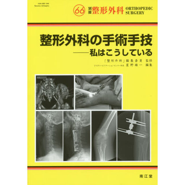 整形外科の手術手技　私はこうしている