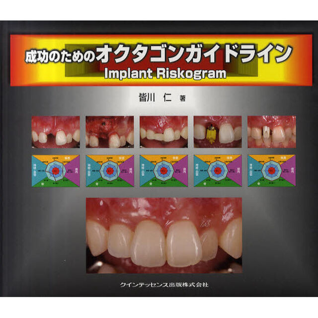成功のためのオクタゴンガイドライン　Ｉｍｐｌａｎｔ　Ｒｉｓｋｏｇｒａｍ