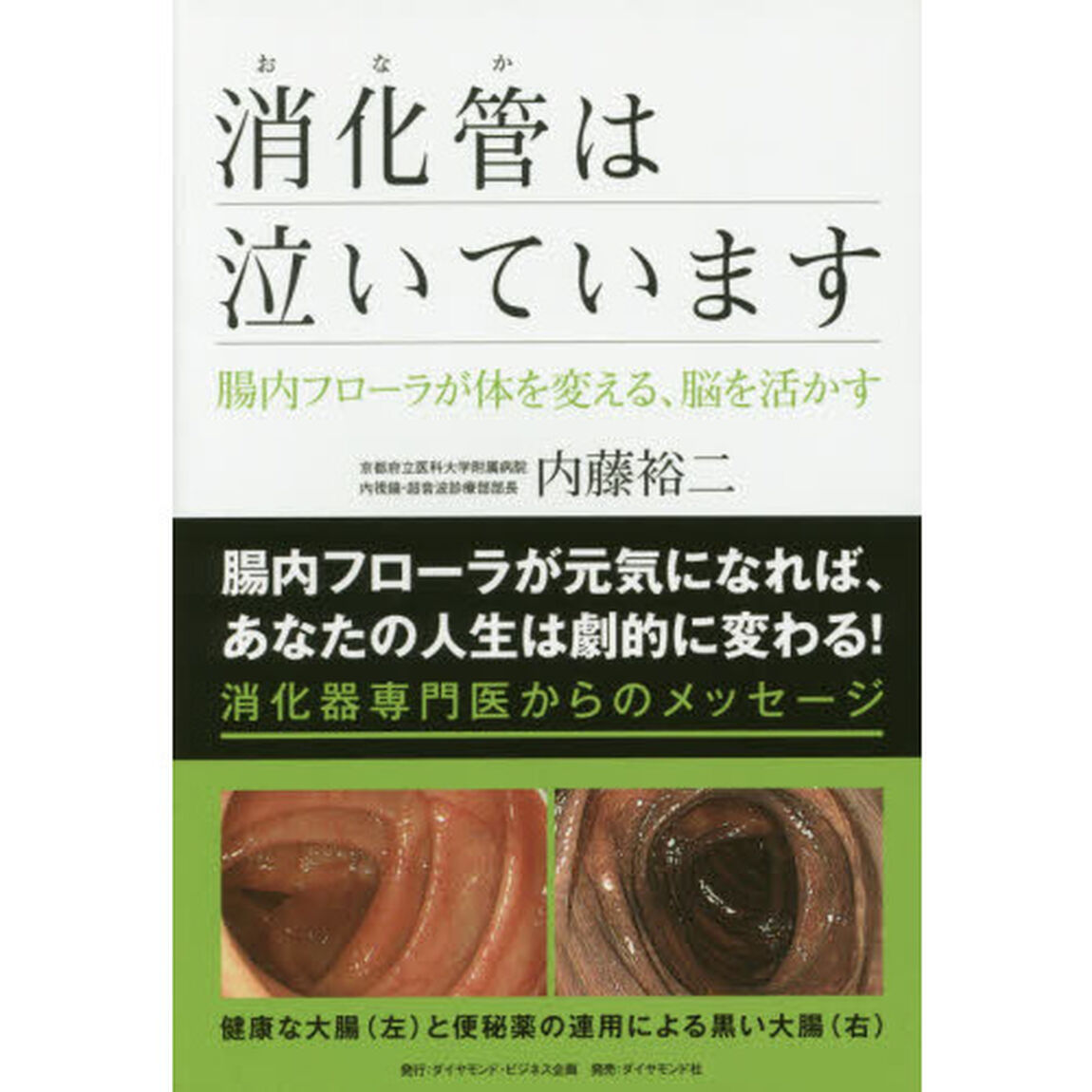 消化管（おなか）は泣いています　腸内フローラが体を変える、脳を活かす