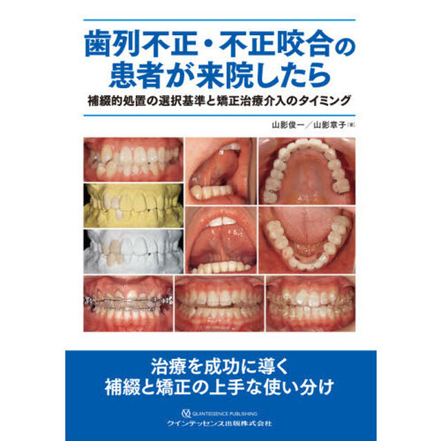 歯列不正・不正咬合の患者が来院したら　補綴的処置の選択基準と矯正治療介入のタイミング