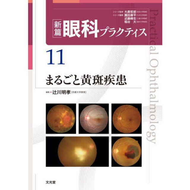 新篇眼科プラクティス　１１「まるごと黄斑疾患」