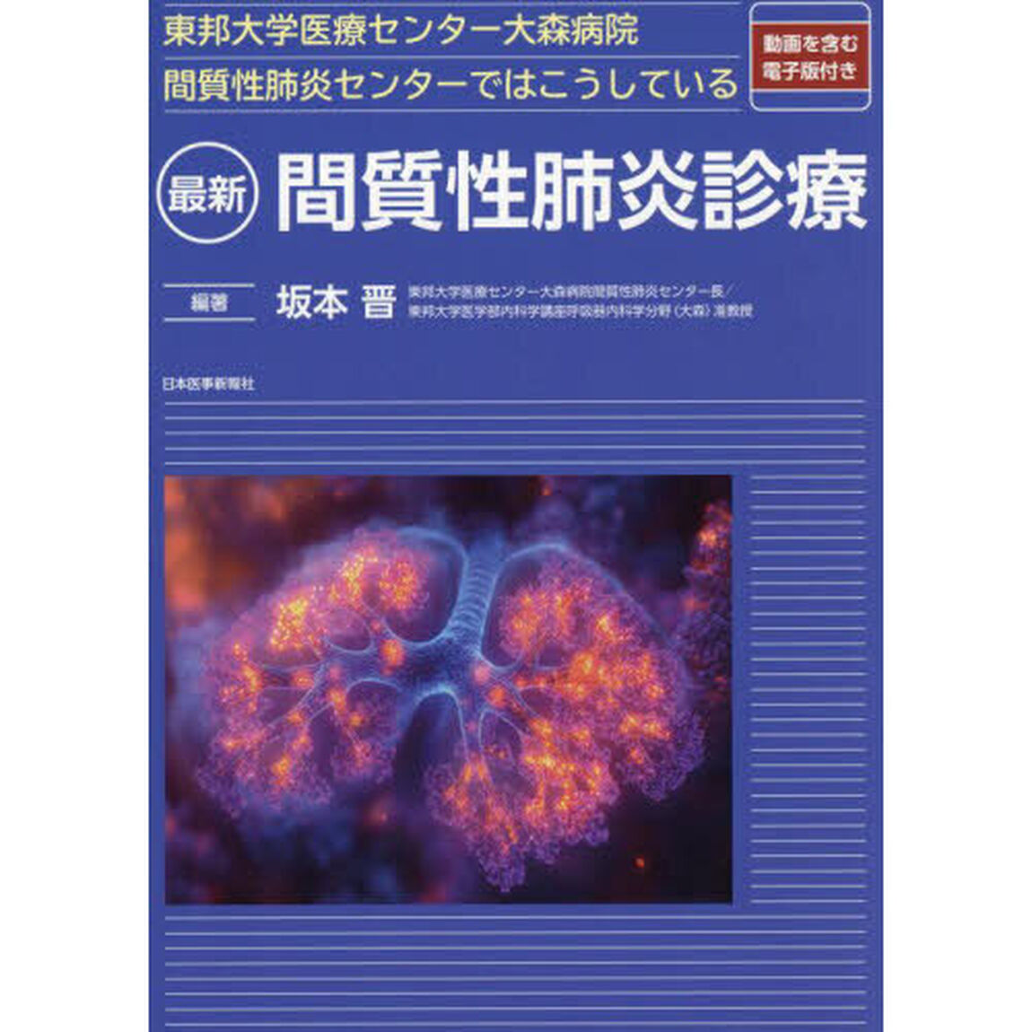 最新間質性肺炎診療　東邦大学医療センター大森病院間質性肺炎センターではこうしている