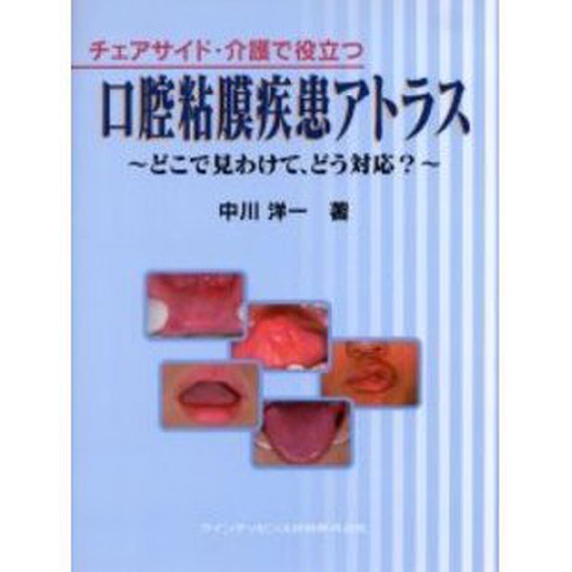 チェアサイド・介護で役立つ口腔粘膜疾患アトラス　どこで見わけて、どう対応？