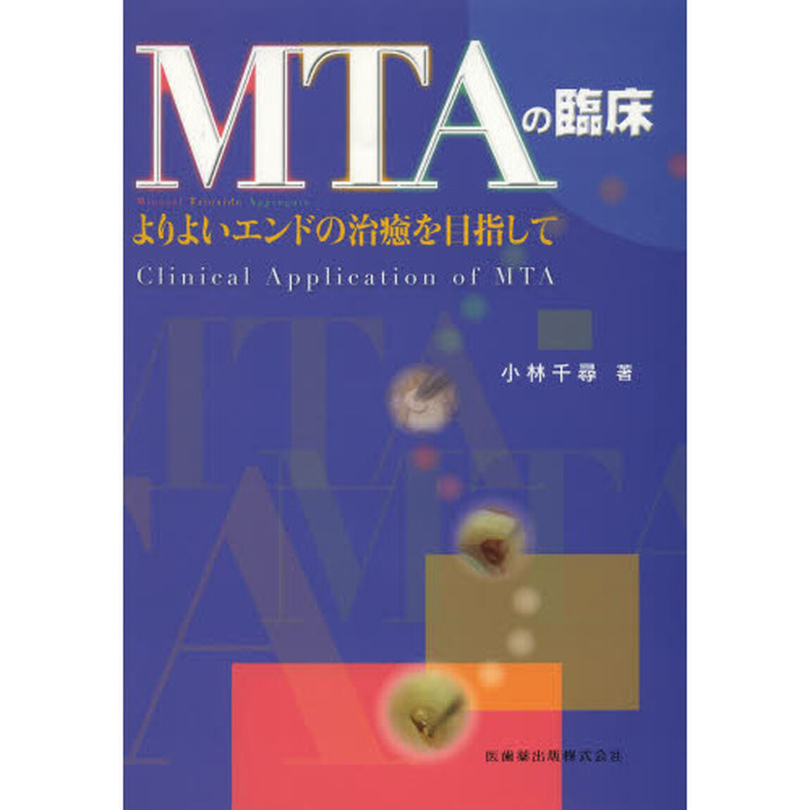 ＭＴＡの臨床　よりよいエンドの治癒を目指して
