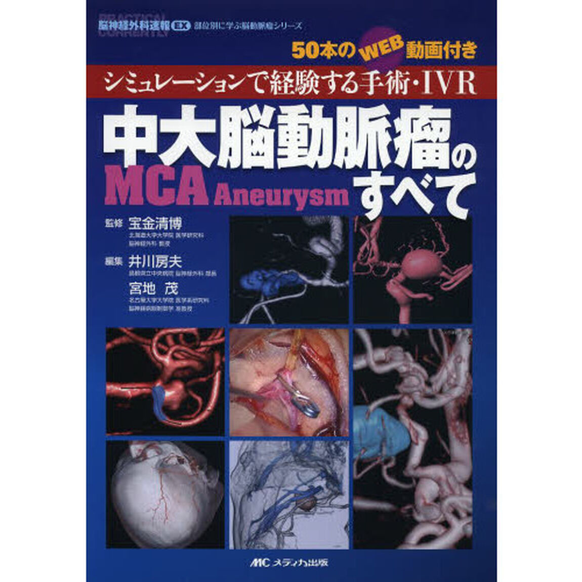 中大脳動脈瘤〈ＭＣＡ　Ａｎｅｕｒｙｓｍ〉のすべて　シミュレーションで経験する手術・ＩＶＲ　５０本のＷＥＢ動画付き
