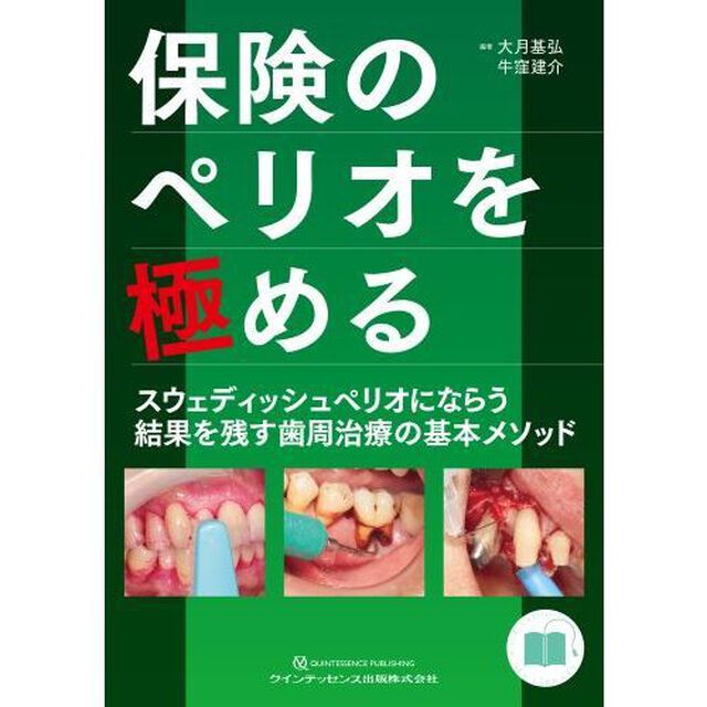 保険のペリオを極める　スウェディッシュペリオにならう結果を残す歯周治療の基本メソッド