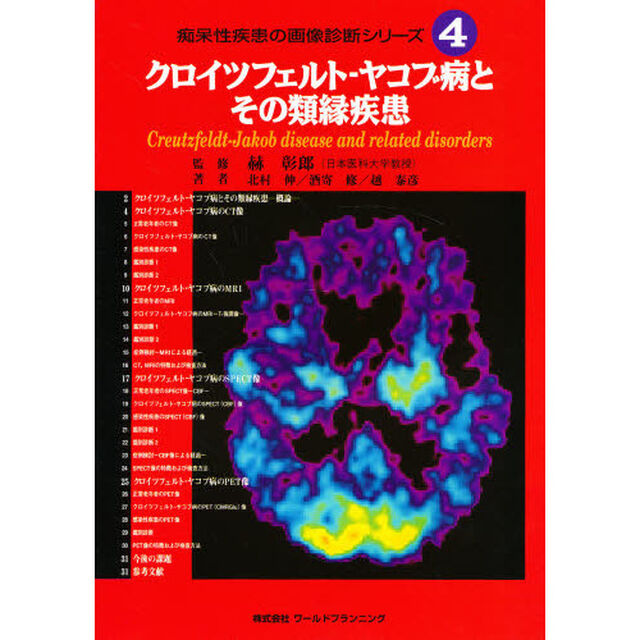 痴呆性疾患の画像診断シリーズ　４「クロイツフェルト－ヤコブ病とその類縁疾患」