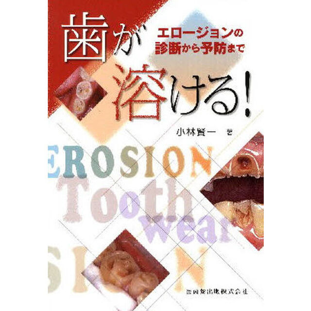 歯が溶ける！　エロージョンの診断から予防まで