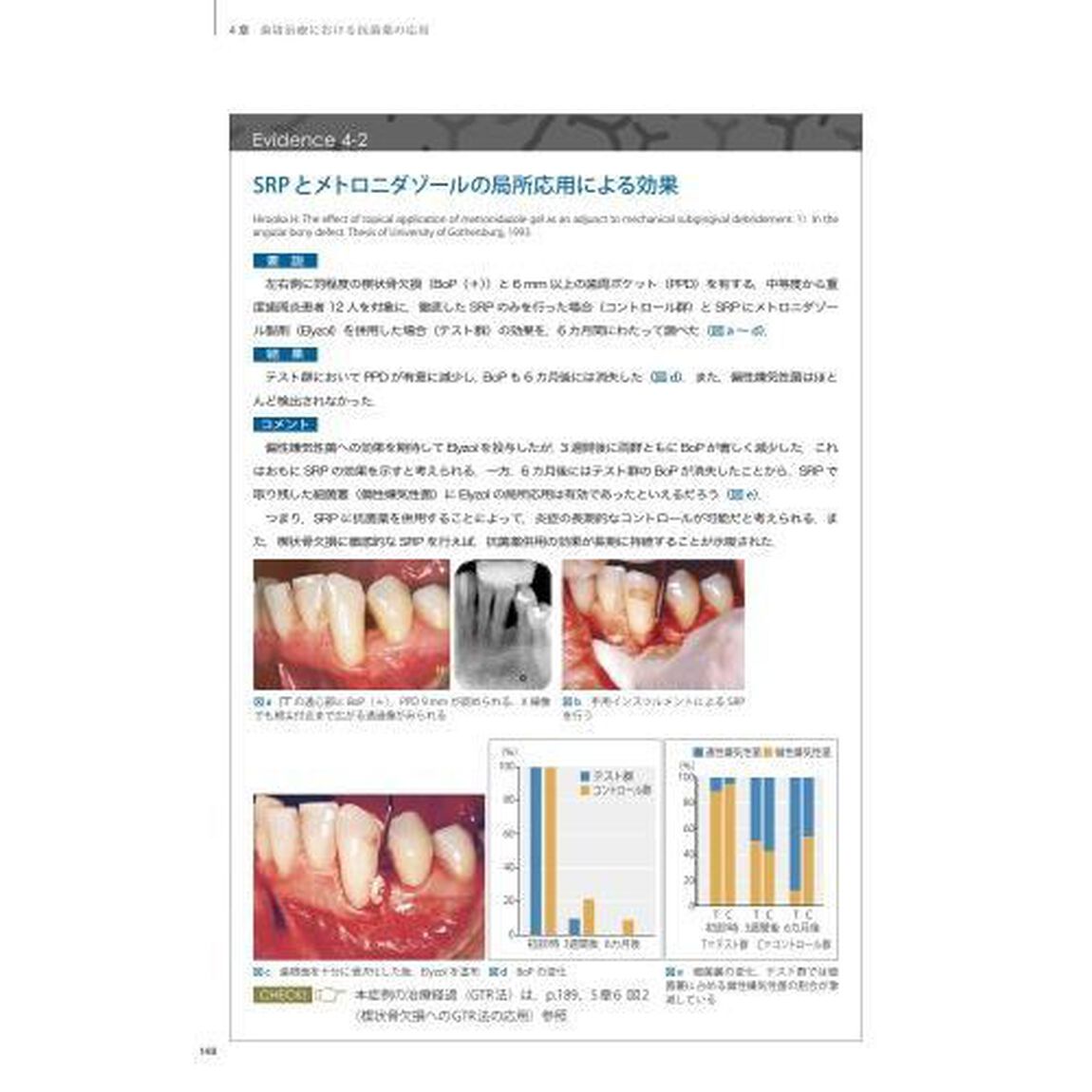 スカンジナビアンアプローチの実践　Ｄｒ．弘岡に訊く臨床的ペリオ講座