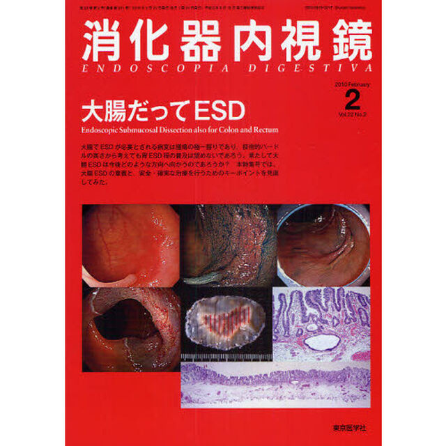 消化器内視鏡　Ｖｏｌ．２２Ｎｏ．２（２０１０Ｆｅｂｒｕａｒｙ）「大腸だってＥＳＤ」