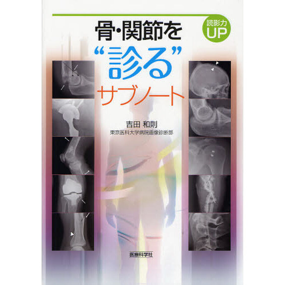 骨・関節を&ldquo;診る&rdquo;サブノート　読影力ＵＰ