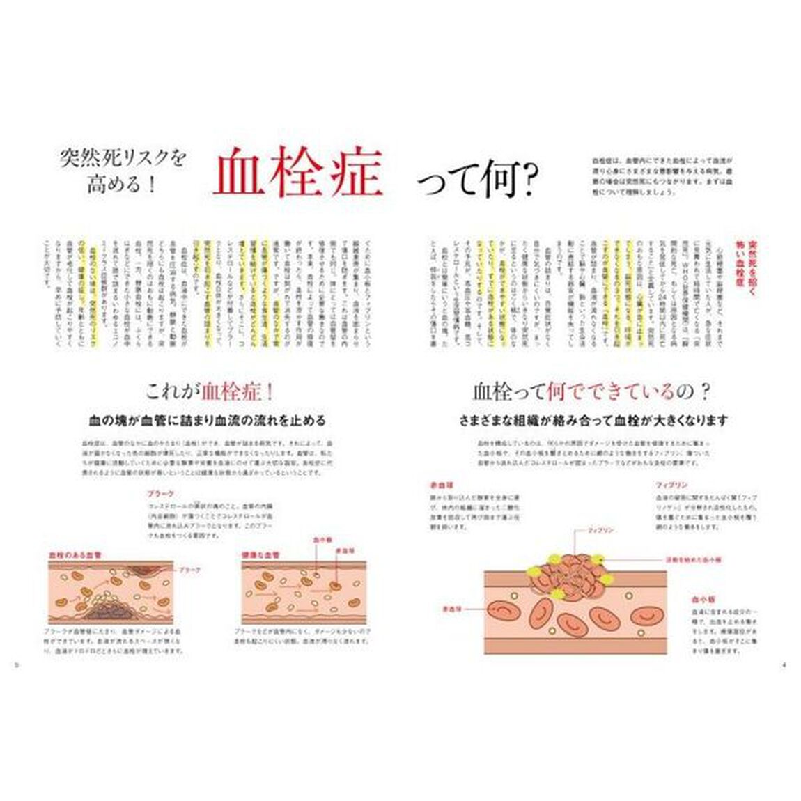 血栓をつくらない！　脳梗塞、心筋梗塞、肺塞栓など突然死のリスクを減らす