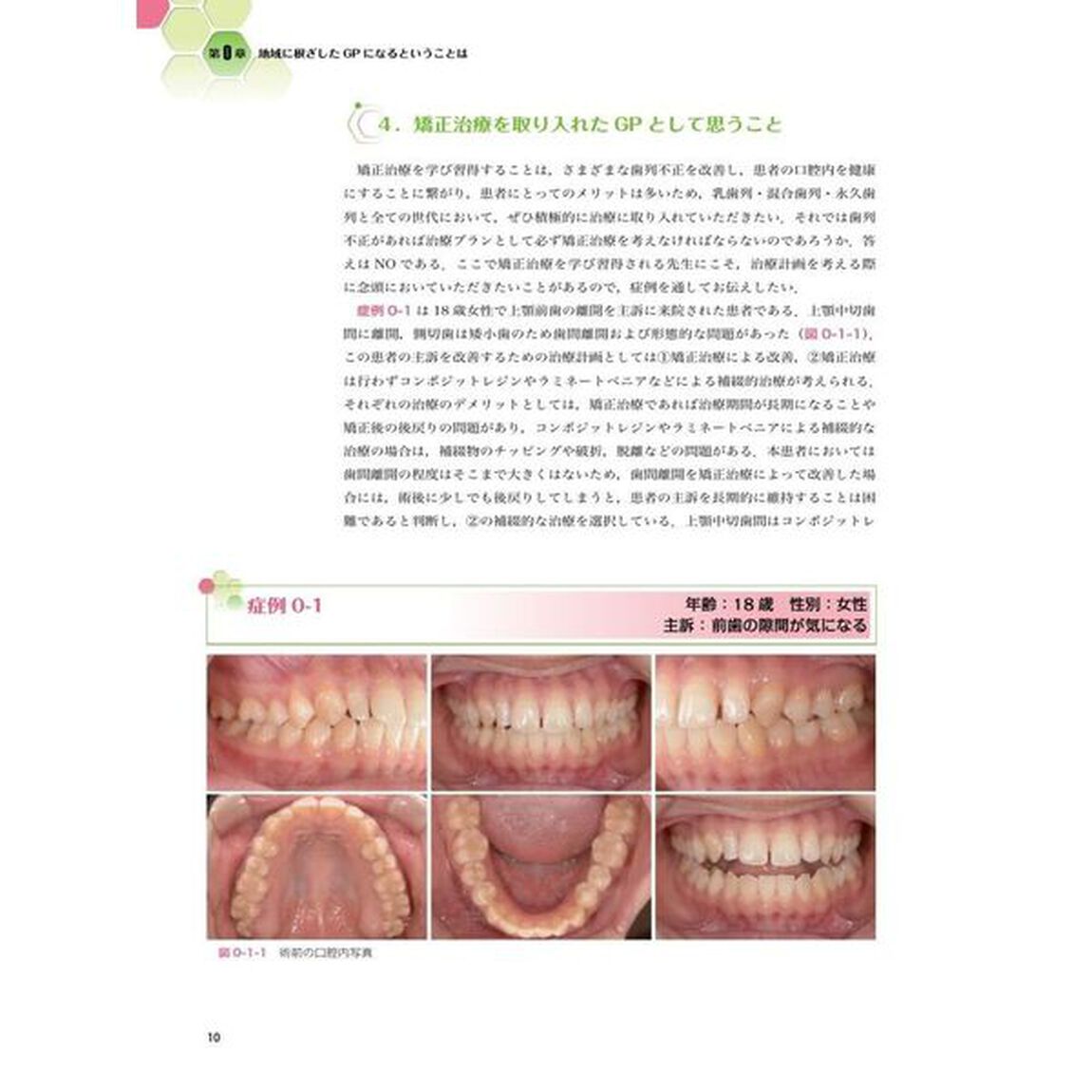 患者思いの歯科矯正治療　ＧＰが実践したい部分矯正・咬合誘導・全顎矯正