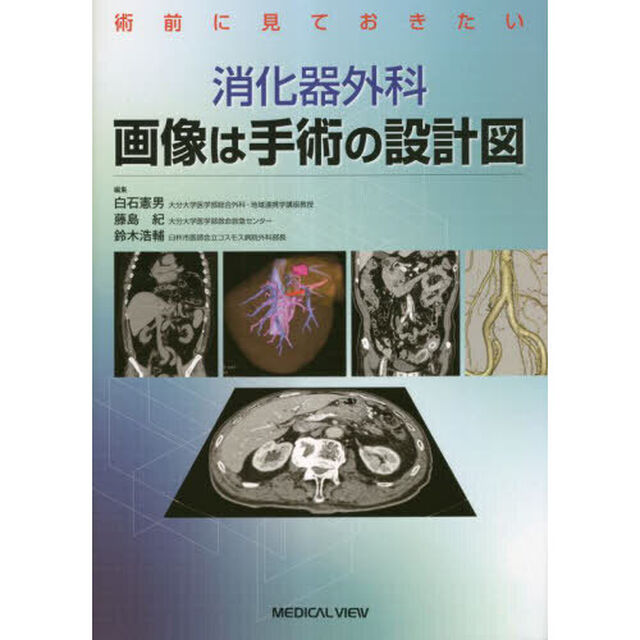 消化器外科画像は手術の設計図　術前に見ておきたい