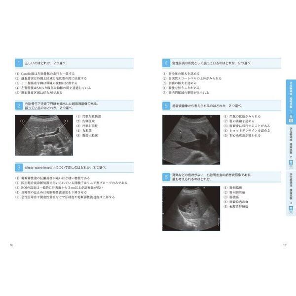 超音波検査士認定試験対策 過去問分析〜出題のポイントで学ぶ！ 臨床編