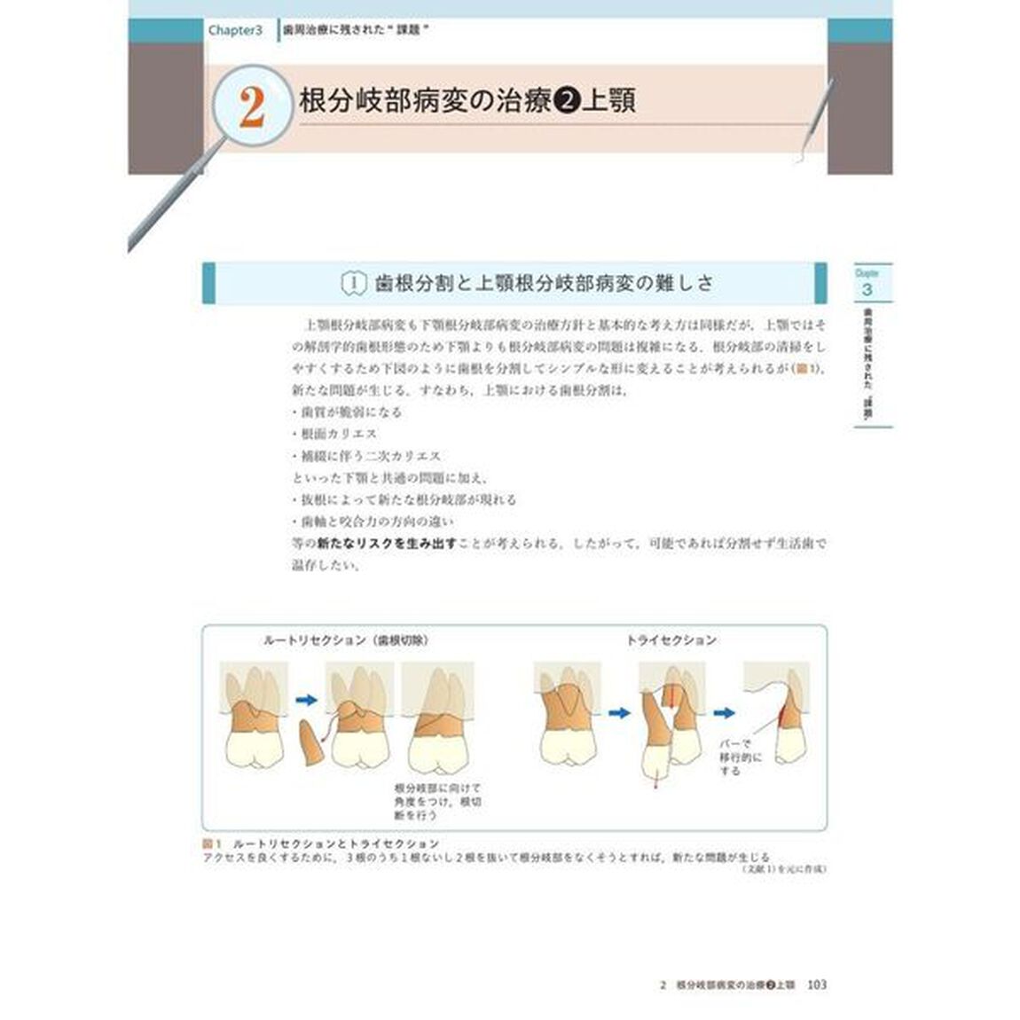 歯科医師・歯科衛生士のための ペリオの治癒形態と治し方