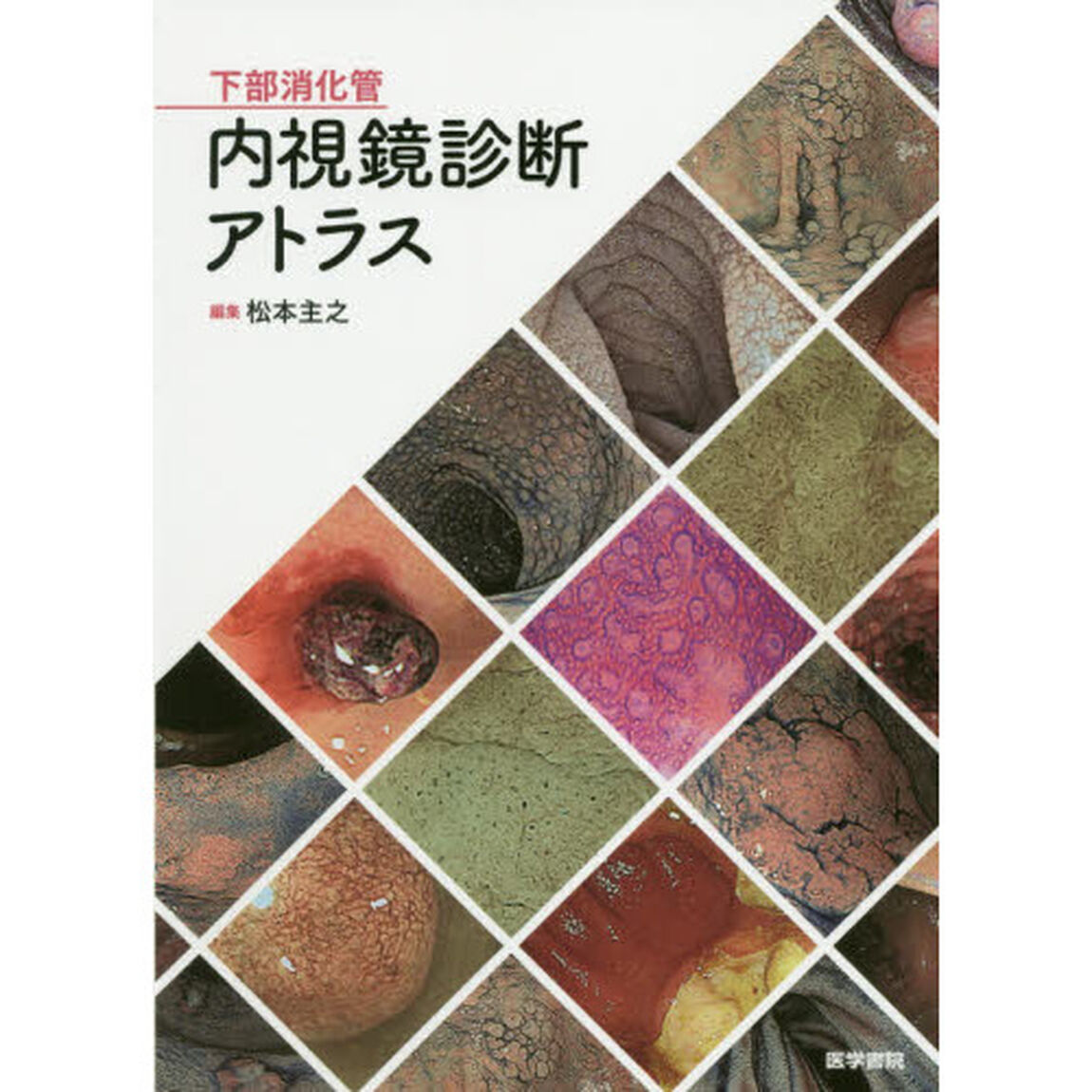 下部消化管内視鏡診断アトラス