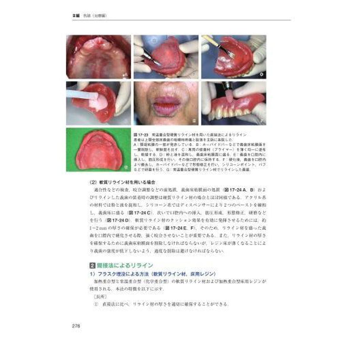 無歯顎補綴治療学「第４版」